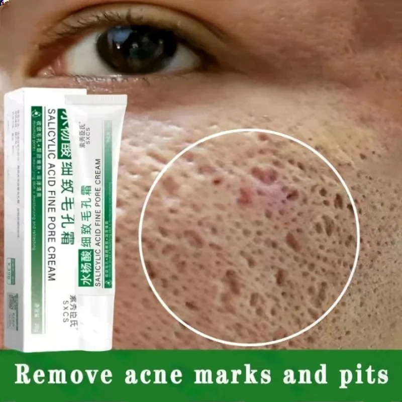 Крем для очищения пор с салици – обзор и цена Collagen Peptide Powder