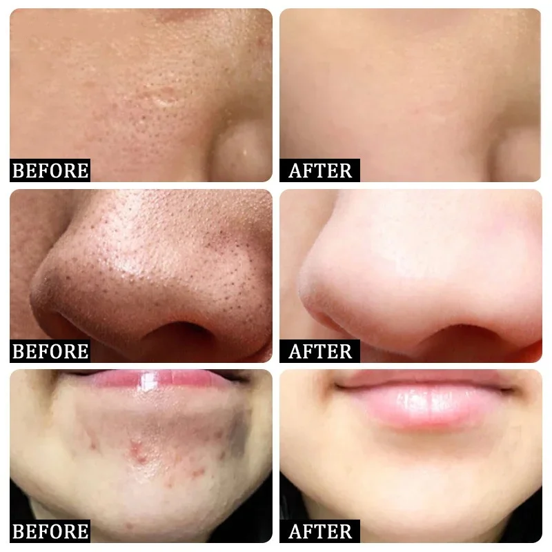 Крем для очищения пор с салици – обзор и цена Collagen Peptide Powder