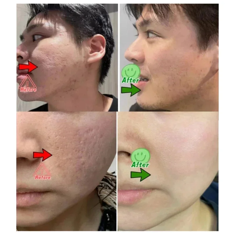 Крем для очищения пор с салици – обзор и цена Collagen Peptide Powder